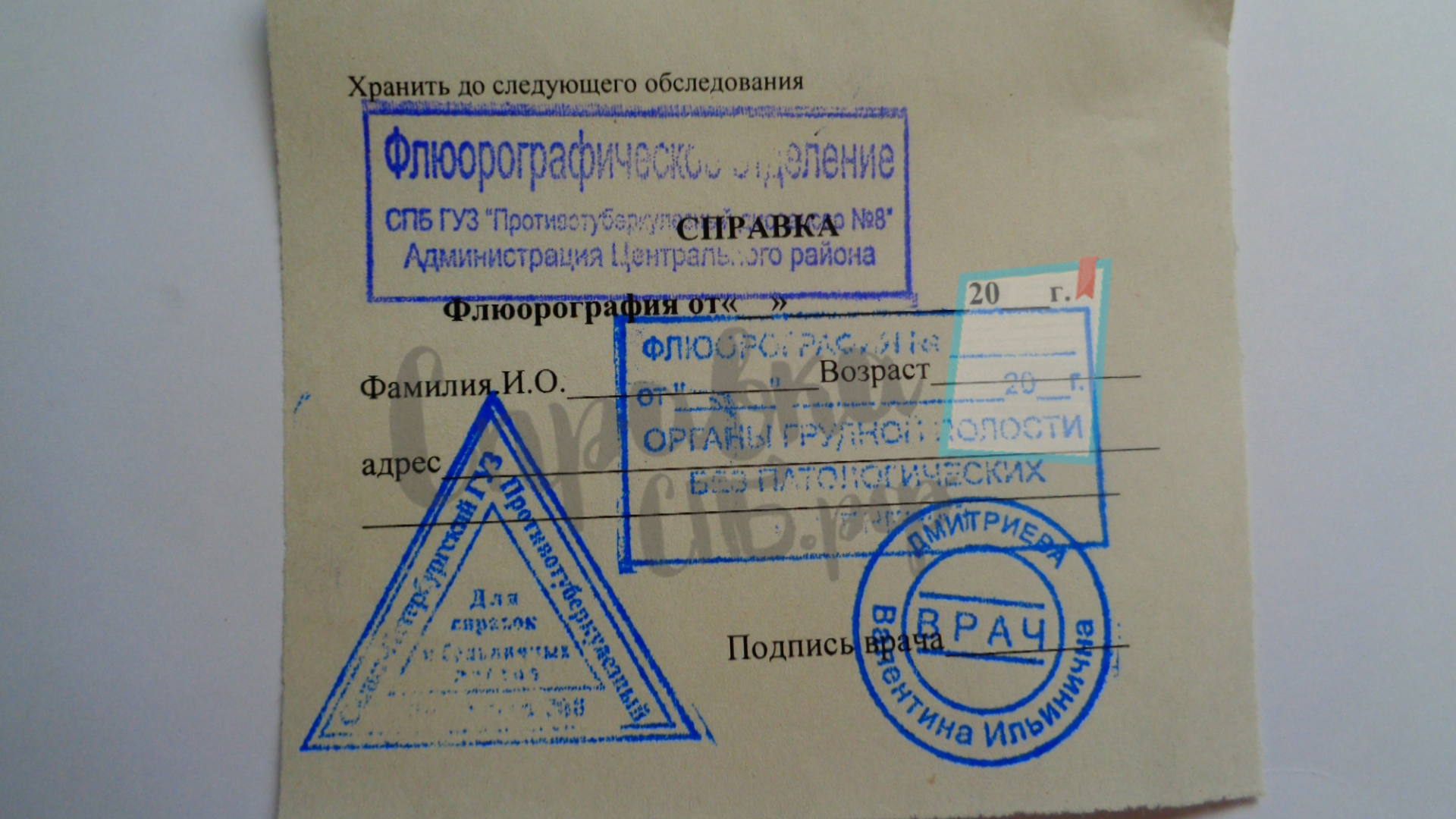 Купить флюорографию в СПб официально и недорого